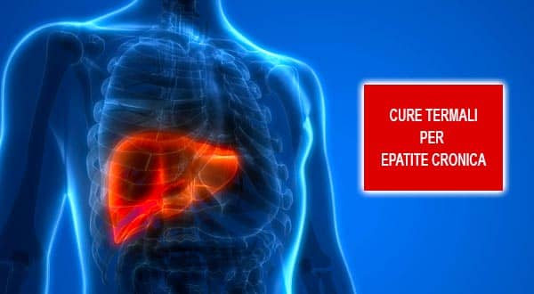 Cure termali per epatite cronica