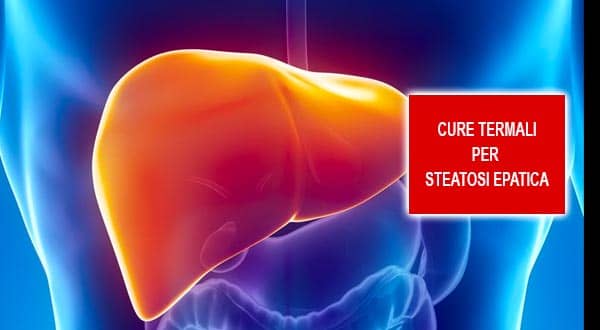 Cure termali per steatosi epatica